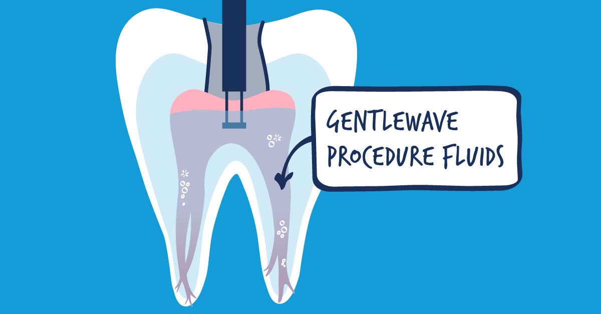 an-alternative-to-standard-root-canal-treatment-gentlewave-procedure